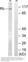 Rb Antibody