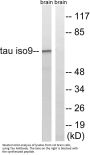 Tau Antibody