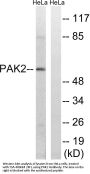 PAKγ Antibody