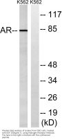 AR Antibody