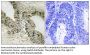 Gab 2 Antibody