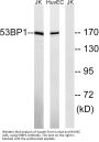 53BP1 Antibody
