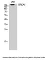 BRCA1 Antibody