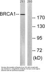 BRCA1 Antibody