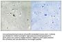 Mucin 1 Antibody