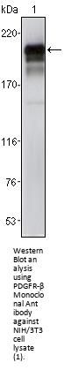 PDGFR-β Antibody