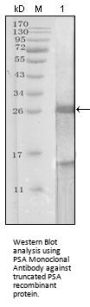 PSA Antibody