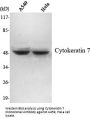 Cytokeratin 7 Antibody