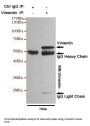 Vimentin Antibody