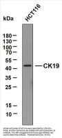 Cytokeratin 19&10 (ABT-CK19) Antibody