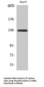 EphA2 (phospho Tyr588) Antibody