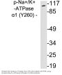 Sodium Potassium ATPase alpha-1 (Phospho Tyr260) Antibody