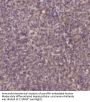 PI 3 kinase p85β (phospho Tyr464) Antibody