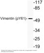Vimentin (phospho Tyr61) Antibody