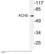 AChE Antibody