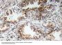 AChRα1 Antibody