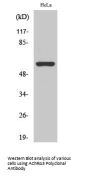 AChRα3 Antibody