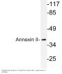 Annexin II Antibody