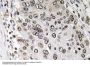 Annexin III Antibody