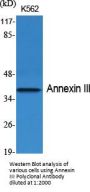 Annexin III Antibody