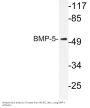 BMP-5 Antibody