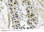 BMP-8 Antibody