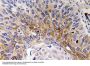 Cardiotrophin-1 Antibody