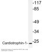 Cardiotrophin-1 Antibody
