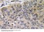 Cathepsin E Antibody