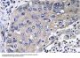 Cathepsin D Antibody