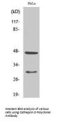 Cathepsin D Antibody