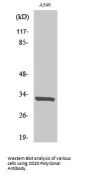 CD20 Antibody