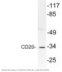 CD20 Antibody