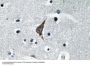 CD284 Antibody
