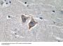 CD57 Antibody