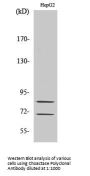 Choactase Antibody