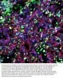 CD15 Antibody