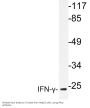IFN-γ Antibody