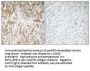 IL-1α Antibody