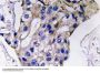IL-5 Antibody
