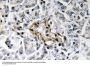 Insulin Antibody