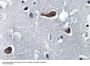 MAP-2 Antibody