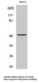 PAH Antibody