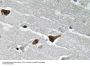 PAI-1 Antibody