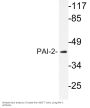 PAI-2 Antibody