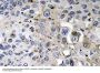 PDGF-A Antibody