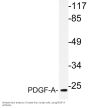 PDGF-A Antibody