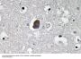 P-glycoprotein 1 Antibody