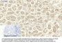PKM2 Antibody