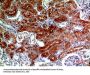 RNase III Drosha Antibody